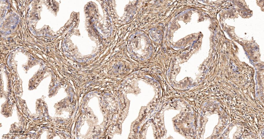 S100钙结合蛋白A4重组兔单抗