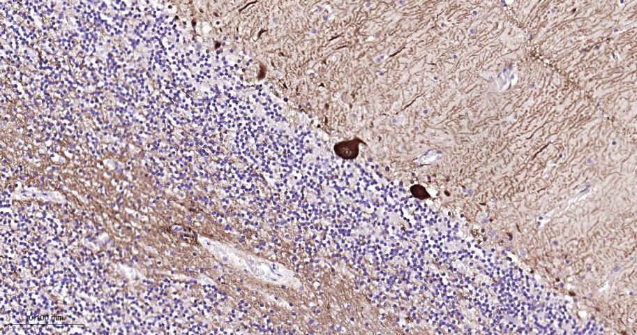 多巴胺/cAMP调节神经磷蛋白重组兔单抗