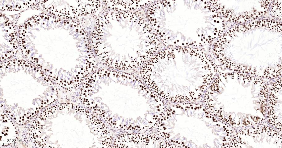 核基质蛋白3重组兔单抗