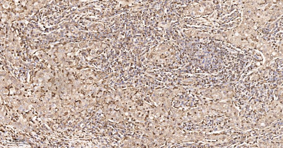 S100钙结合蛋白A4重组兔单抗