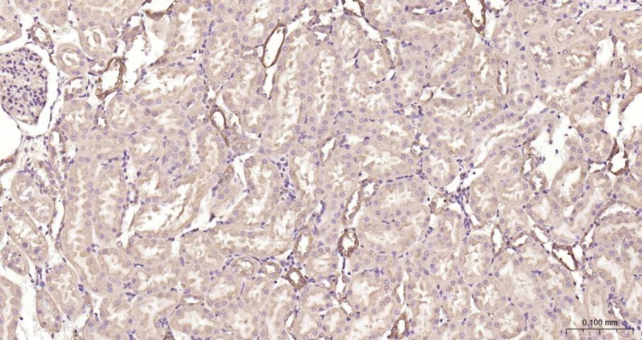 硫氧还蛋白结合蛋白2重组兔单抗