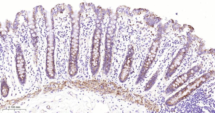 硫辛酰胺脱氢酶重组兔单抗