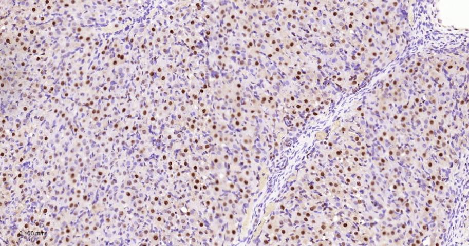 核基质蛋白3重组兔单抗