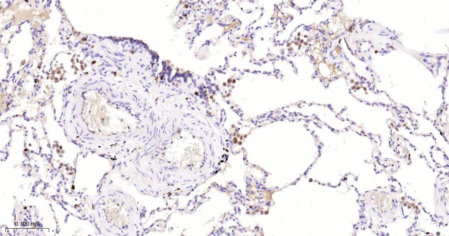 Rho GTP酶激活蛋白5重组兔单抗