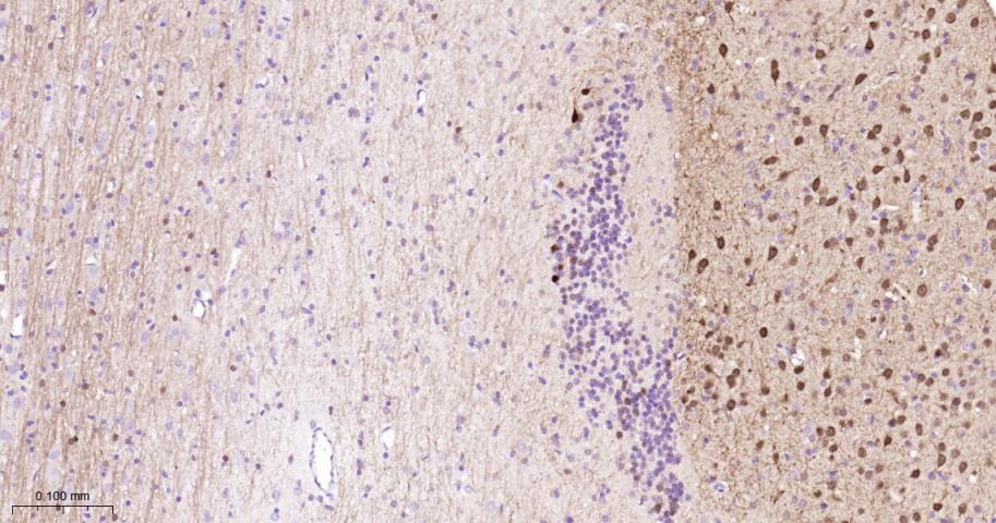 多巴胺/cAMP调节神经磷蛋白重组兔单抗