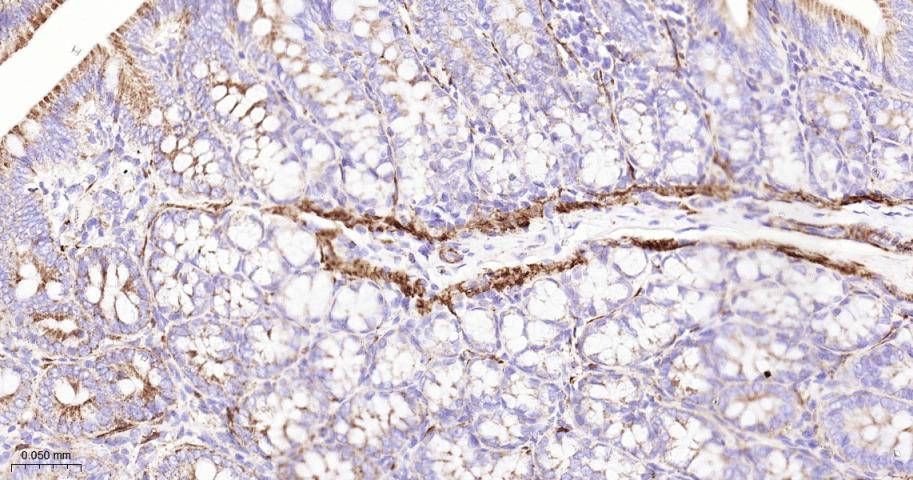 硫辛酰胺脱氢酶重组兔单抗