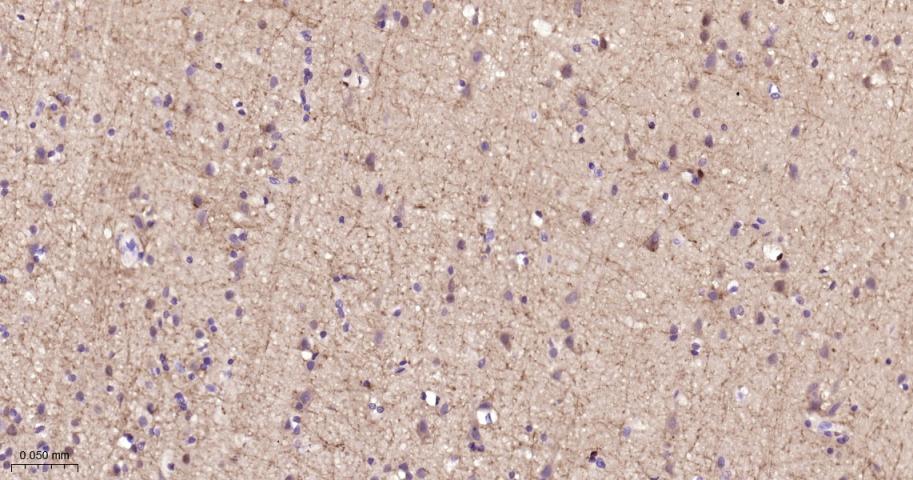 多巴胺/cAMP调节神经磷蛋白重组兔单抗