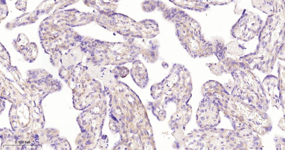 超氧化物歧化酶3重组兔单抗