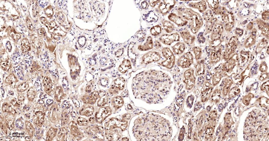 去泛素酶10重组兔单抗