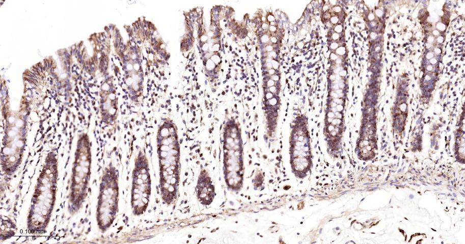 去泛素酶10重组兔单抗