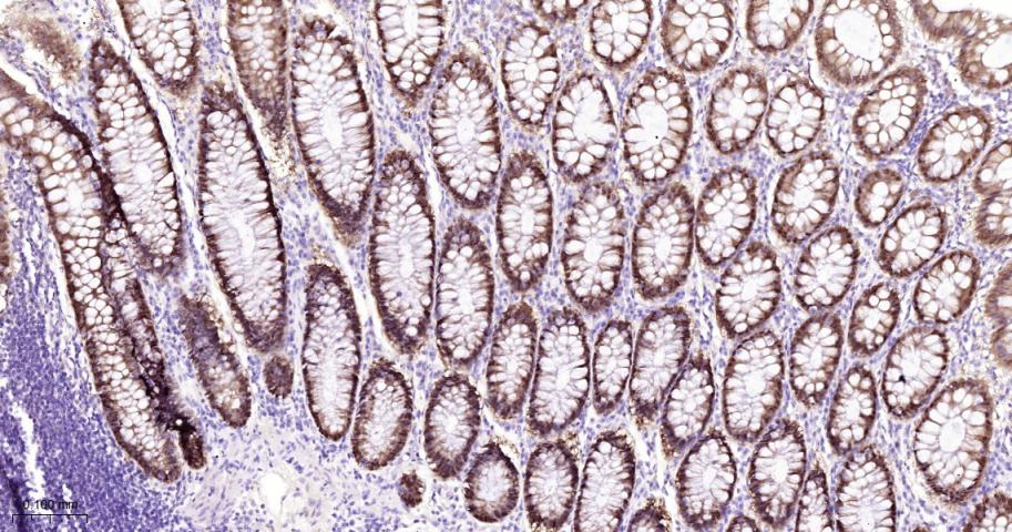 多巴胺/cAMP调节神经磷蛋白重组兔单抗