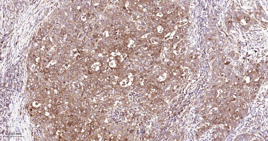 去泛素酶10重组兔单抗