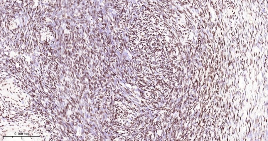 核基质蛋白3重组兔单抗