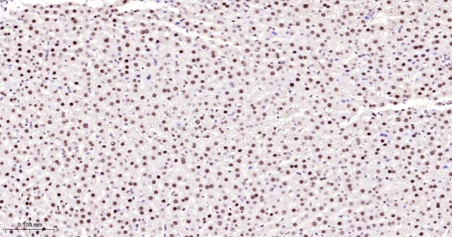 核基质蛋白3重组兔单抗