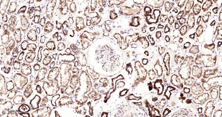 硫辛酰胺脱氢酶重组兔单抗