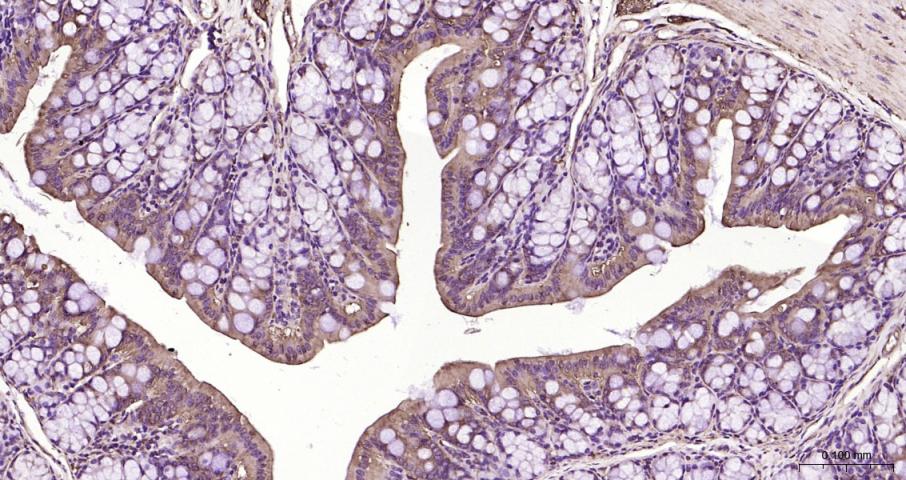 硫氧还蛋白结合蛋白2重组兔单抗