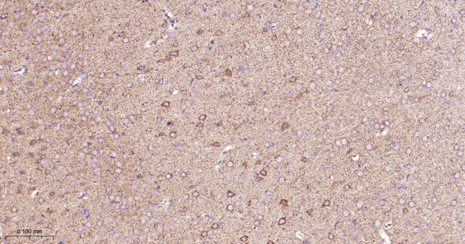 硫辛酰胺脱氢酶重组兔单抗