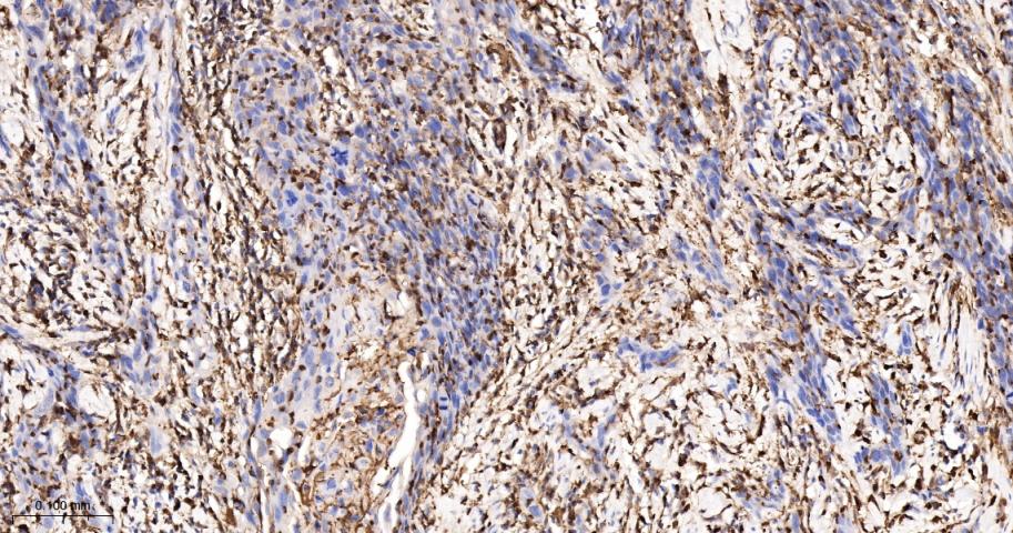 S100钙结合蛋白A4重组兔单抗
