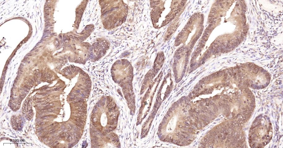 eIF4E结合蛋白重组兔单抗