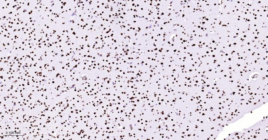 核基质蛋白3重组兔单抗