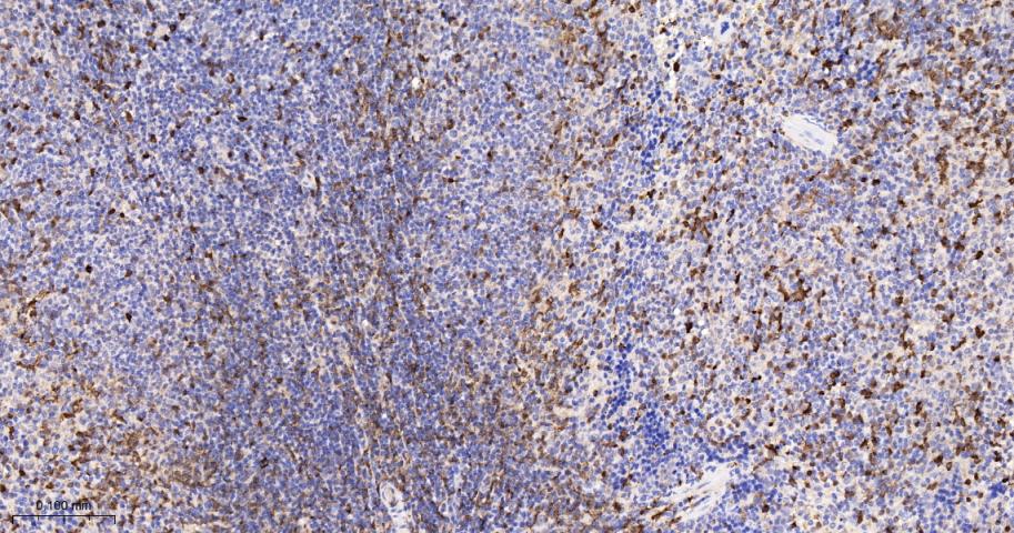 S100钙结合蛋白A4重组兔单抗