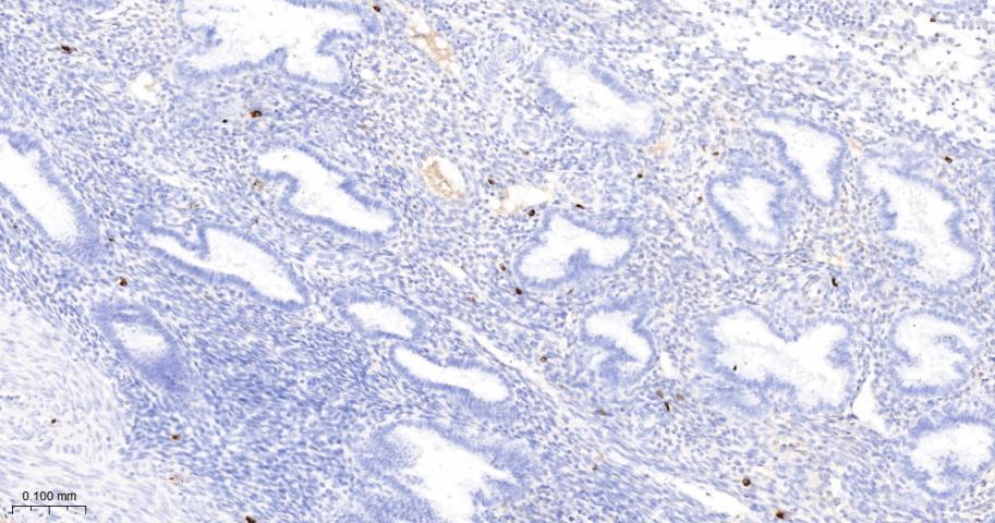 肥大细胞类糜蛋白酶1重组兔单抗