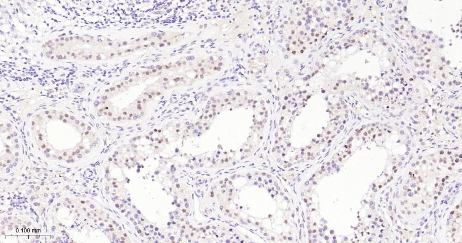EHMT2重组兔单抗