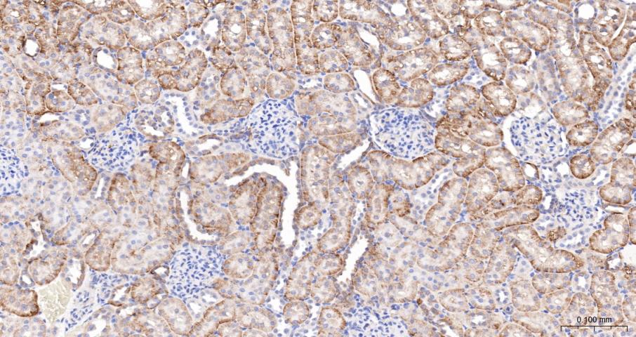磷酸化原癌基因Yes相关蛋白1重组兔单抗