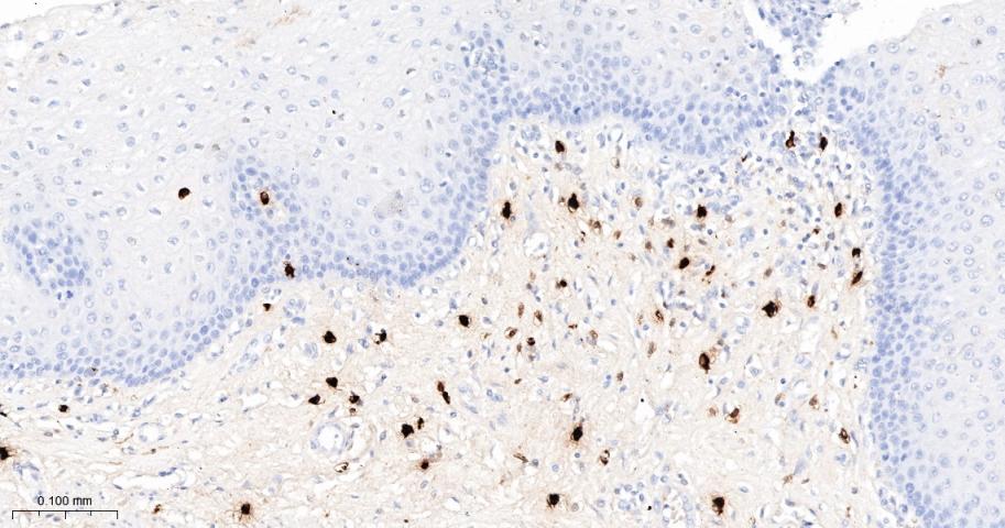 肥大细胞类糜蛋白酶1重组兔单抗