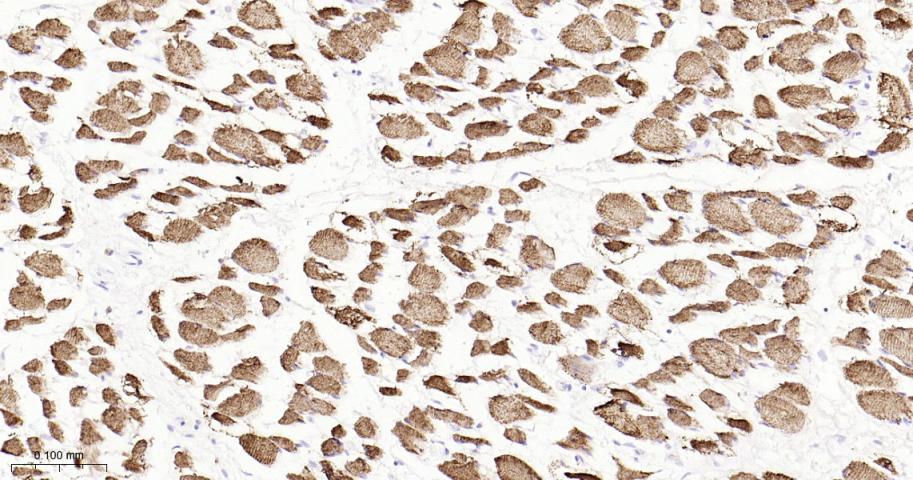 肌钙集蛋白/收钙素重组兔单抗