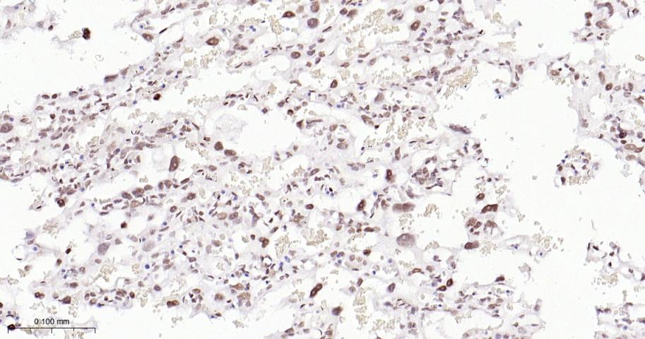 EHMT2重组兔单抗