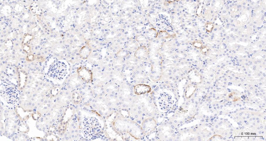 磷酸化原癌基因Yes相关蛋白1重组兔单抗