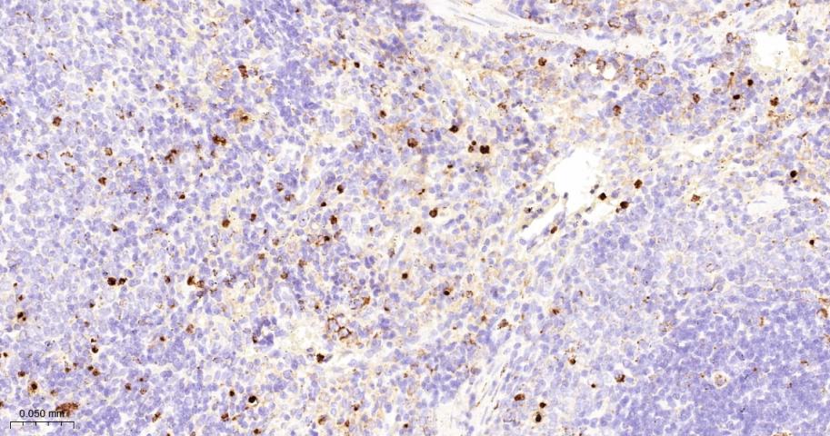 髓过氧化物酶重组兔单抗