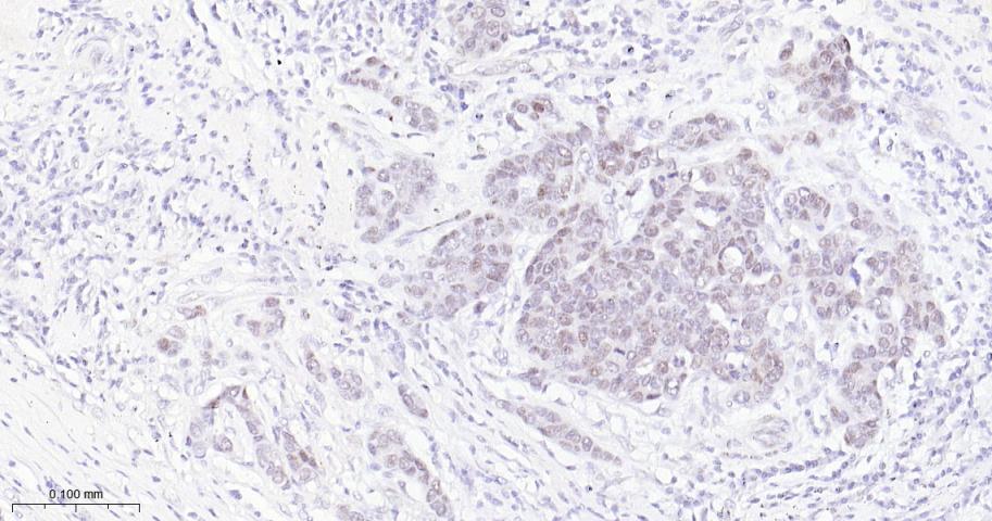 EHMT2重组兔单抗