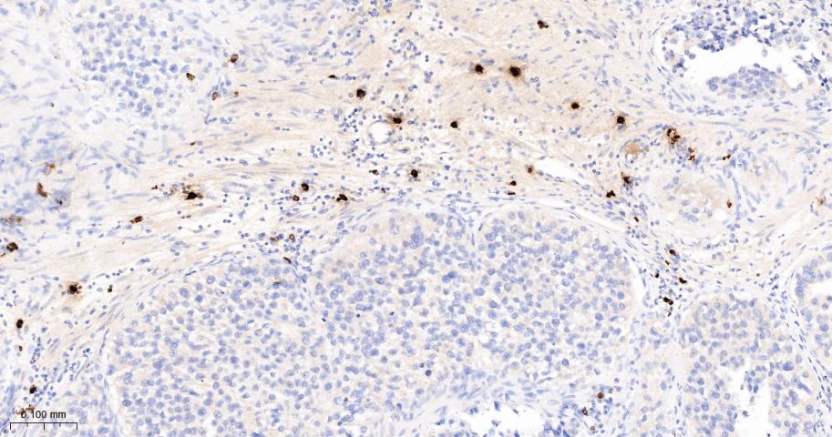 肥大细胞类糜蛋白酶1重组兔单抗