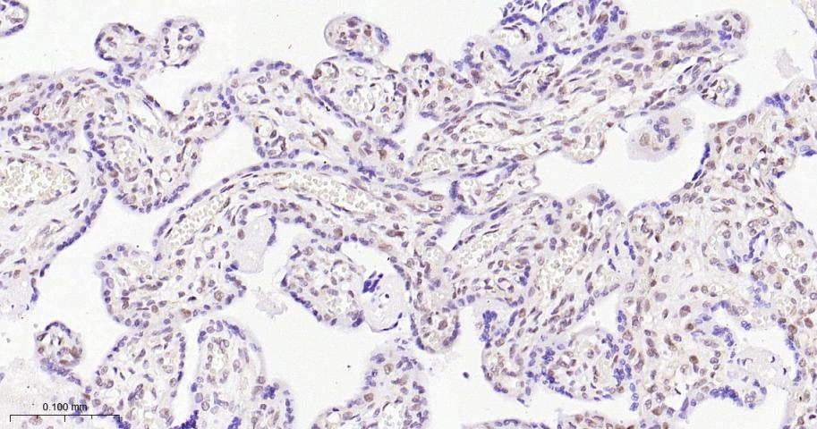 EHMT2重组兔单抗