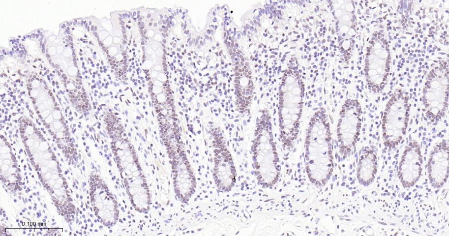 EHMT2重组兔单抗