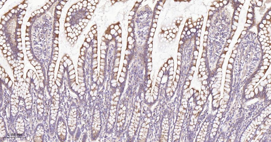 Rho GTP酶激活蛋白GAP重组兔单抗