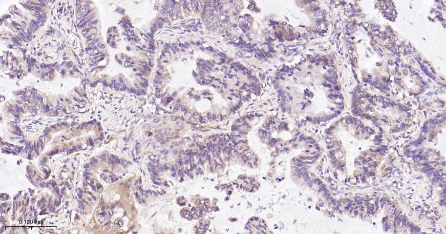 Rho GTP酶激活蛋白GAP重组兔单抗
