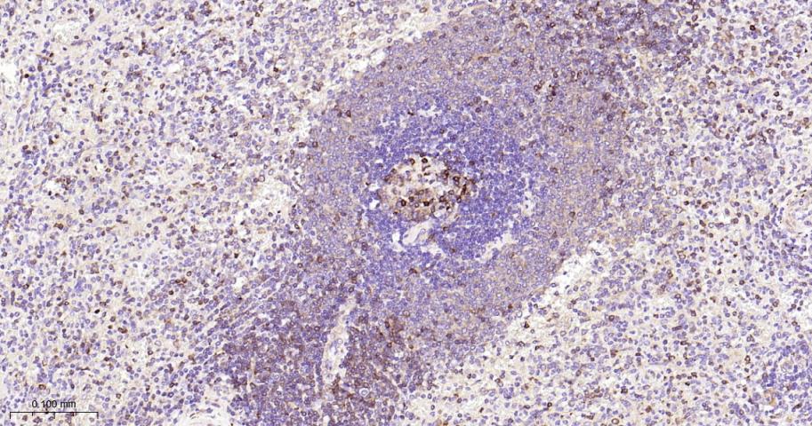 丝氨酸/苏氨酸蛋白激酶39重组兔单抗