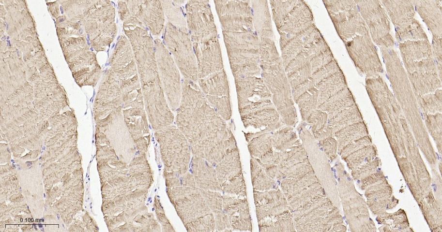 肌钙集蛋白/收钙素重组兔单抗