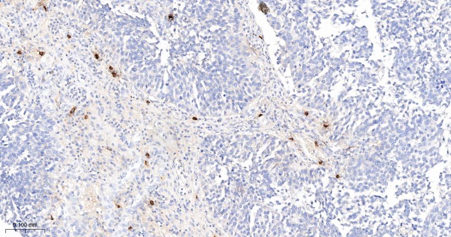 肥大细胞类糜蛋白酶1重组兔单抗