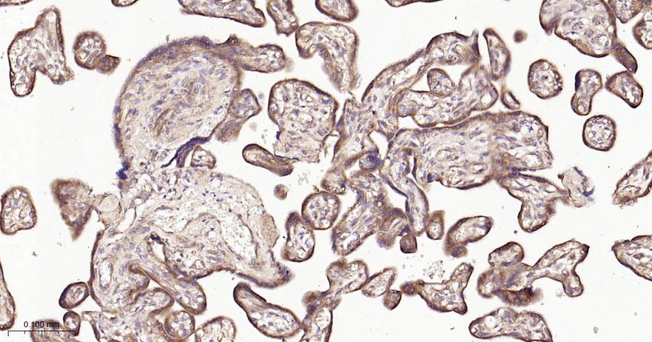 Rho GTP酶激活蛋白GAP重组兔单抗