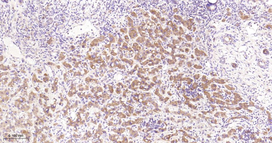 Rho GTP酶激活蛋白GAP重组兔单抗