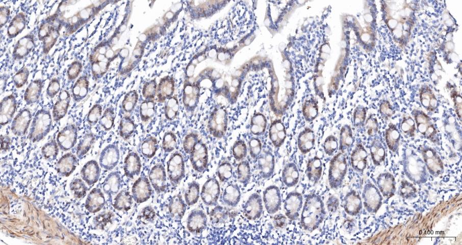 磷酸化原癌基因Yes相关蛋白1重组兔单抗