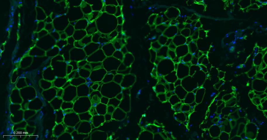 脂滴包被蛋白Perilipin-A重组兔单抗