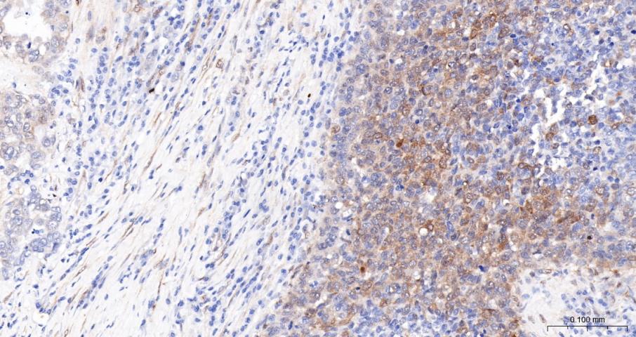 磷酸化原癌基因Yes相关蛋白1重组兔单抗
