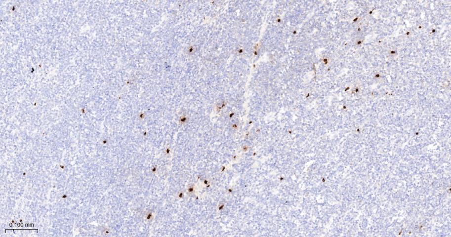 肥大细胞类糜蛋白酶1重组兔单抗