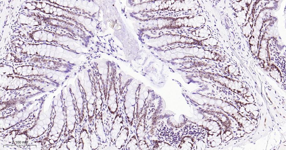 EHMT2重组兔单抗