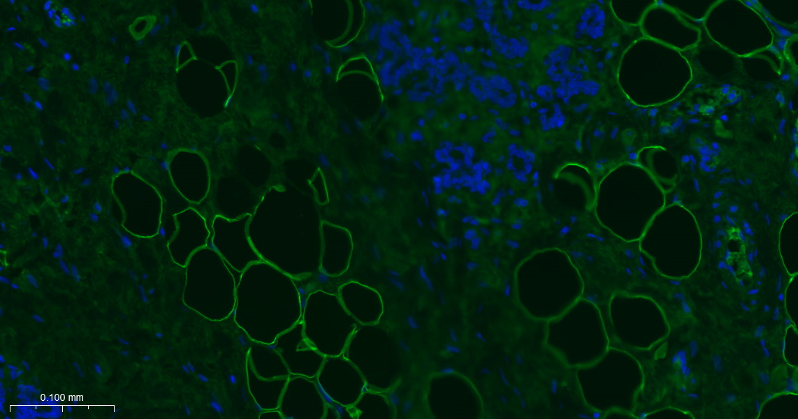 脂滴包被蛋白Perilipin-A重组兔单抗